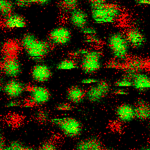 Image Single Molecule Detection