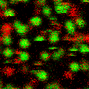 Single Molecule Detection