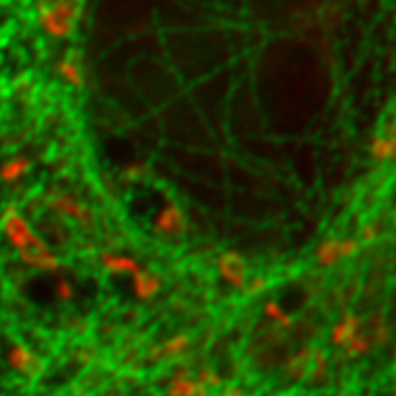 Confocal image - U2OS cell labeled for tubulin with Abberior STAR 635p (green) and giantin with Atto647N 