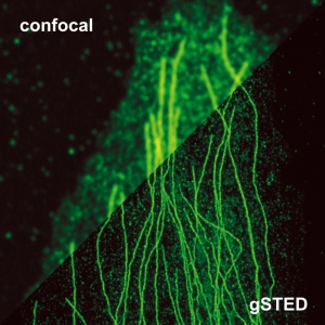 Stimulated Emission Depletion Microscopy (STED)