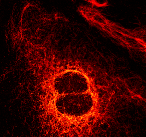 STED image of Vimentin fibers