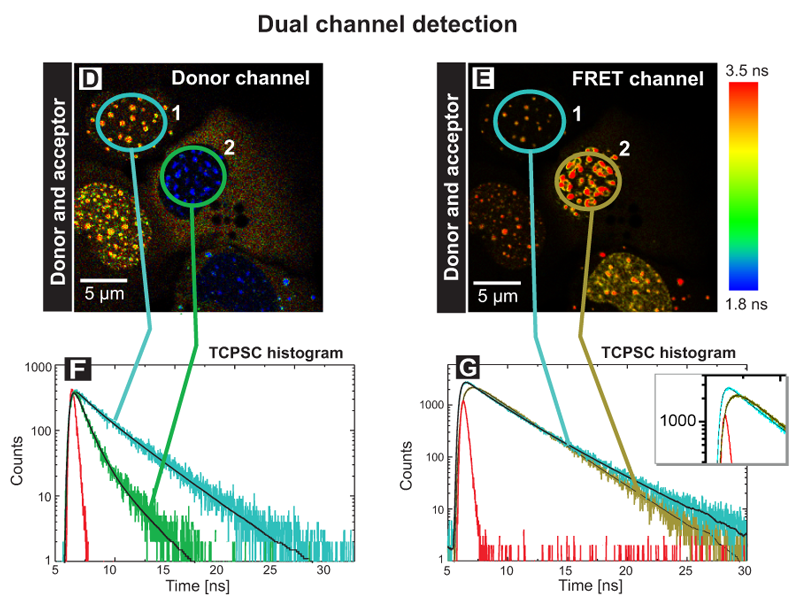 FLIM-FRET measurements of the human kinetochore proteins CENP‑A and CENP‑B in a  dual channel detection set-up