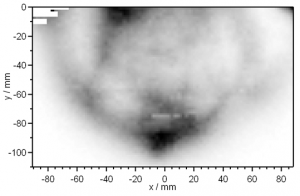 Diffuse Optical Tomography and Imaging