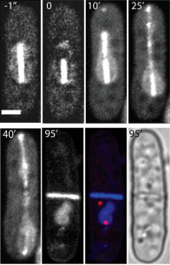 Creation of enucleated cells via nanosurgery