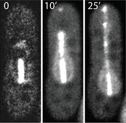 Image Laser cutting/ablation