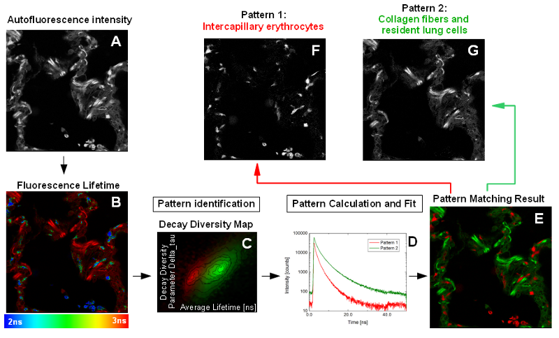 Applying the pattern matching approach for tissue analysis in FLIM images