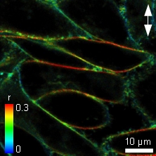 Anisotropy image from the membrane structure reporte probe c6-nbd-pc