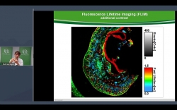 How Fluorescence Lifetime Imaging (FLIM) can help you solve daily research challenges