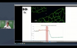 How Fluorescence Lifetime Imaging (FLIM) can help you solve daily research challenges