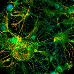 Luminosa – Explore new paths in confocal microscopy