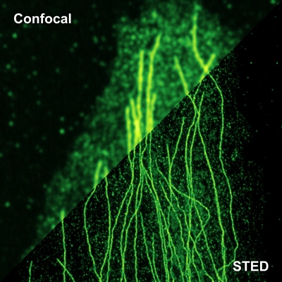 The image shows part of a Vero cell labeled for Tubulin with Abberior STAR 635P