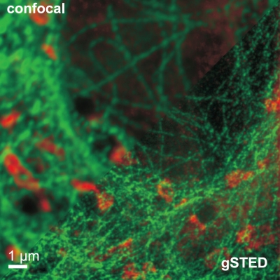 STED sample: image of tubulin 