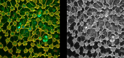 Two-photon excited autofluorescence of a plant leaf. Both images show a maximum intensity projection of the imaged volume. In the FLIM image (on the left) structures with very similar brightness can be clearly distinguished by their very different fl