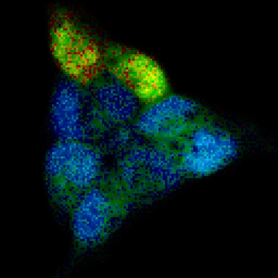 With rapidFLIMHiRes the rise of calcium ion concentration in the cells shown in the picture can be quantitatively observed over a short time period.