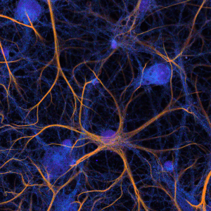 Confocal fluorescence lifetime image of fixed and stained neurons. 3 labels emitting in a single detection channel were discriminated by fluorescence lifetime fitting, and fit results are overlaid.