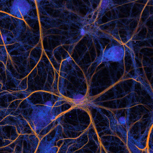 Fluorescence microscopy on a new level