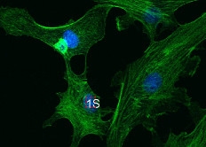 ROI Scanning Using Pulsed Lasers and an Olympus FluoView FV1000 or FluoView FV300