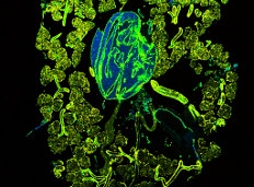 Fluorescence Lifetime Imaging (FLIM) in Confocal Microscopy Applications: An Overview