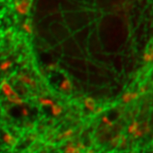 Confocal image - U2OS cell labeled for tubulin with Abberior STAR 635p (green) and giantin with Atto647N