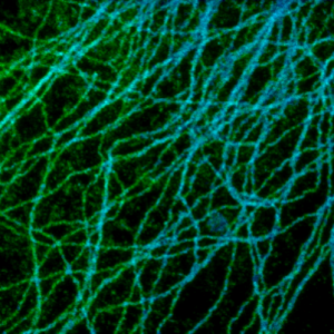 STED image of tubulin structures STED image of tubulin structures