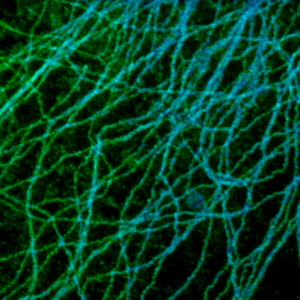 STED image of tubulin structures 