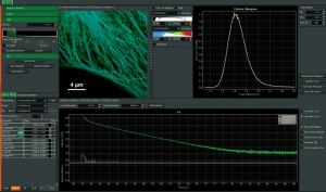 Screen shot of the SymPhoTime 64 STED software