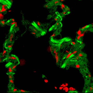 Autofluorescence image of the alveolar compartment of peripheral human lung tissue. Pattern matching analysis discriminates signals from intercapillary erythrocytes (red) and collagen fibers and resident lung cells (green).