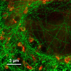 Dual-color STED image of microtubules of U2OS cells stained with Abberior Star 635P and Giantin labeled with Atto 647N.