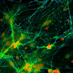 Presynaptic Bassoon and postsynaptic Homer clusters in fixed neurons. Sample courtesy of Rizzoli group, Department of Neuro- and Sensory Physiology, University of Göttingen Medical Center.