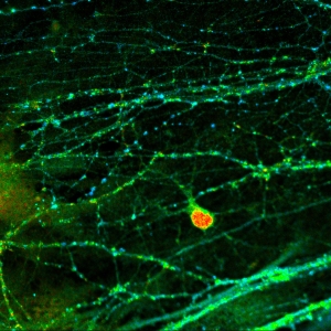 Presynaptic Bassoon and postsynaptic Homer clusters in fixed neurons. Sample courtesy of Rizzoli group, Department of Neuro- and Sensory Physiology, University of Göttingen Medical Center.