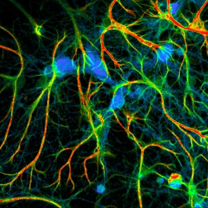 Fixed neurons stained for synapses (PSD95), intermediate filaments (GFAP), and mitochondria (TOM20). Sample courtesy of Rizzoli group, Department of Neuro- and Sensory Physiology, University of Göttingen Medical Center.
