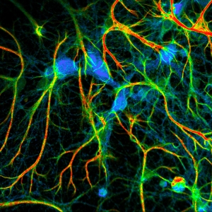 Fixed neurons stained for synapses (PSD95), intermediate filaments (GFAP), and mitochondria (TOM20). Sample courtesy of Rizzoli group, Department of Neuro- and Sensory Physiology, University of Göttingen Medical Center.