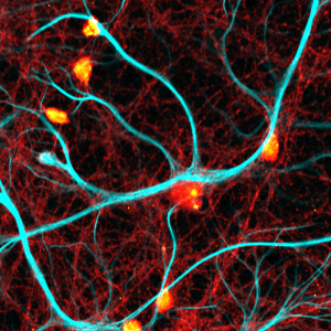 FLIM image using pattern matching of fixed neurons stained for synapses (PSD95, red hot), and intermediate filaments (GFAP, cyan). Sample courtesy of Rizzoli group, Department of Neuro- and Sensory Physiology, Univ. Göttingen Medical Center.