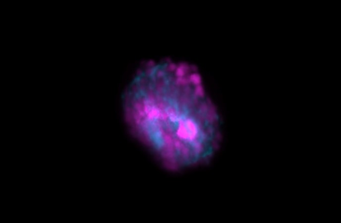 rapid 3D FLIM imaging in living organoids