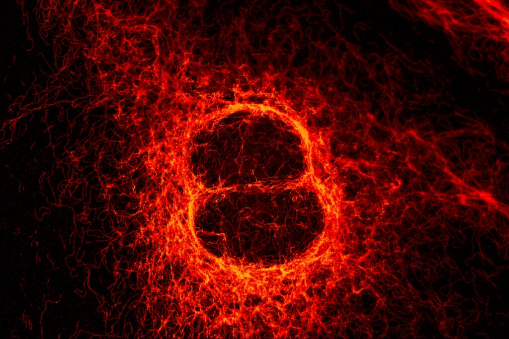 STED vimentin-fibers