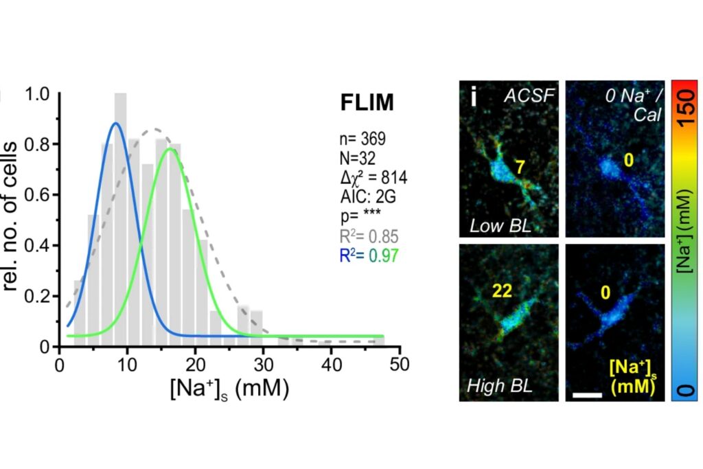 FLIM measurements of somatic intracellular Na⁺ in 369 astrocytes from 32 tissue slice preparations revealed a broad, bimodal distribution with peaks near 9 and 17 mM. A double Gaussian model described the data significantly better than a single Gaussian fit (Δχ² = 814, p < 0.0001).