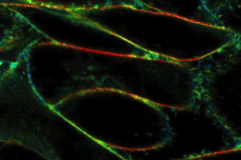 Fluorescence lifetime imaging microscopy (FLIM) of CHO cells reveals spatial heterogeneity and dynamic organization along cellular membranes.