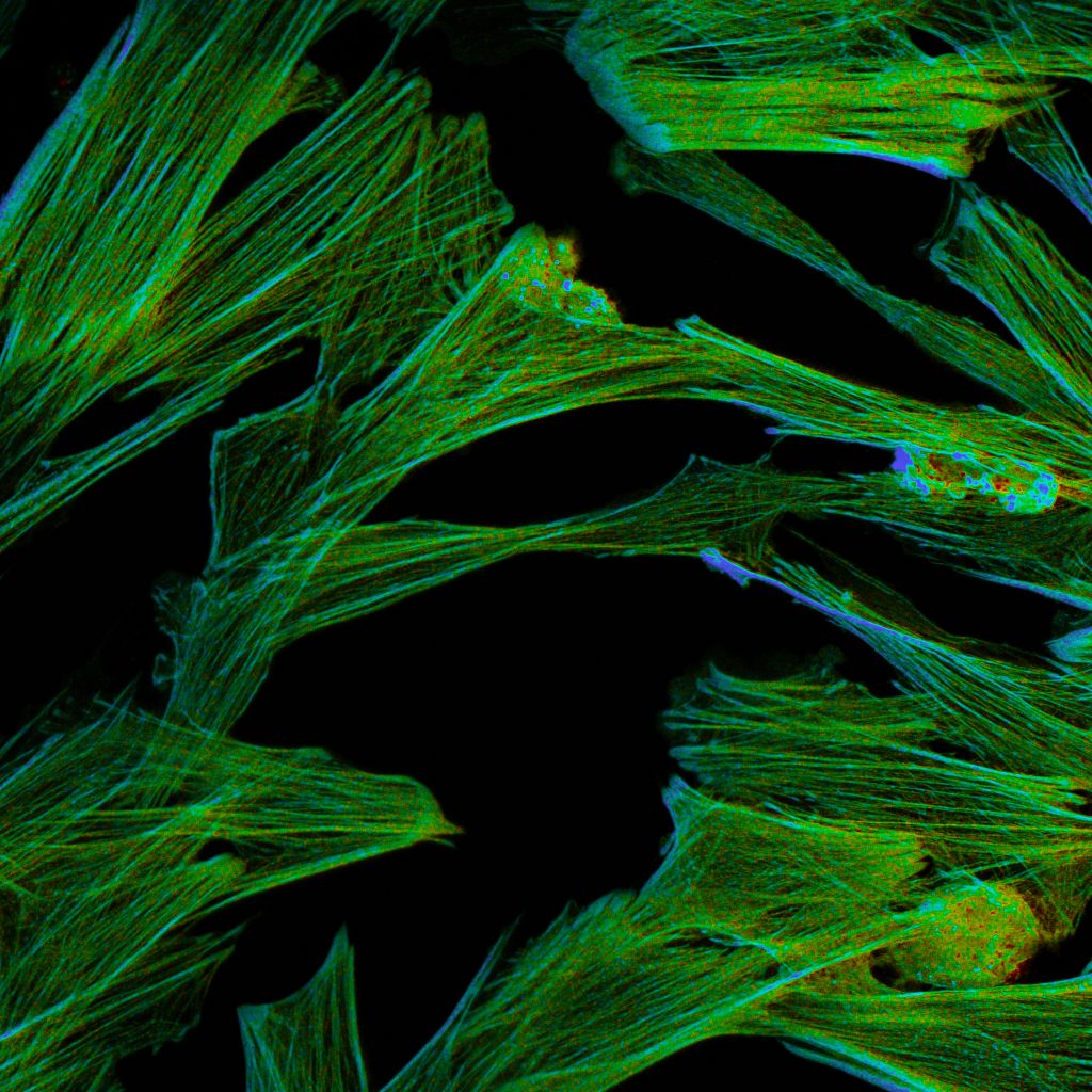 Component-resolved FLIM image of cultured cells illustrating spatial contributions of multiple fluorescence lifetime components and molecular heterogeneity.