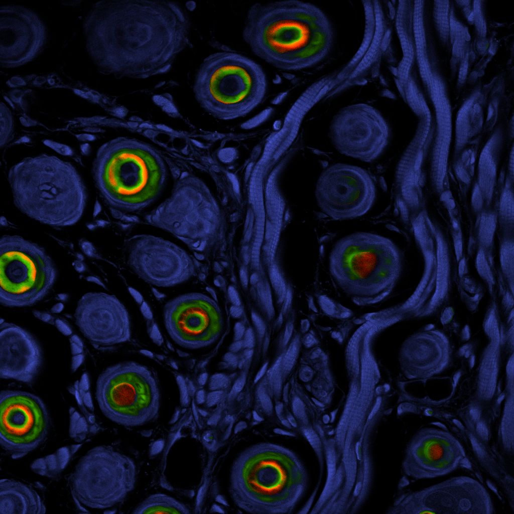 Component-resolved fluorescence lifetime imaging microscopy image separating distinct lifetime populations within mouse tissue.