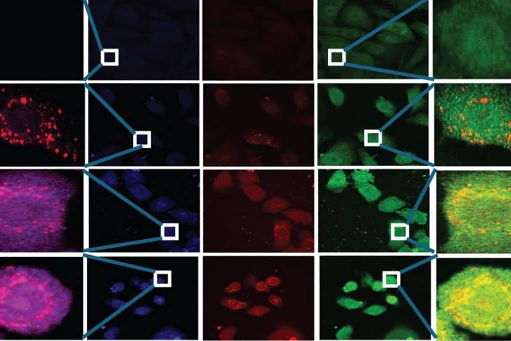Representative confocal immunofluorescence overlays showing LC3B, LAMP1, and PLAC8 localization during progressive cadmium-induced transformation of prostate epithelial cells.