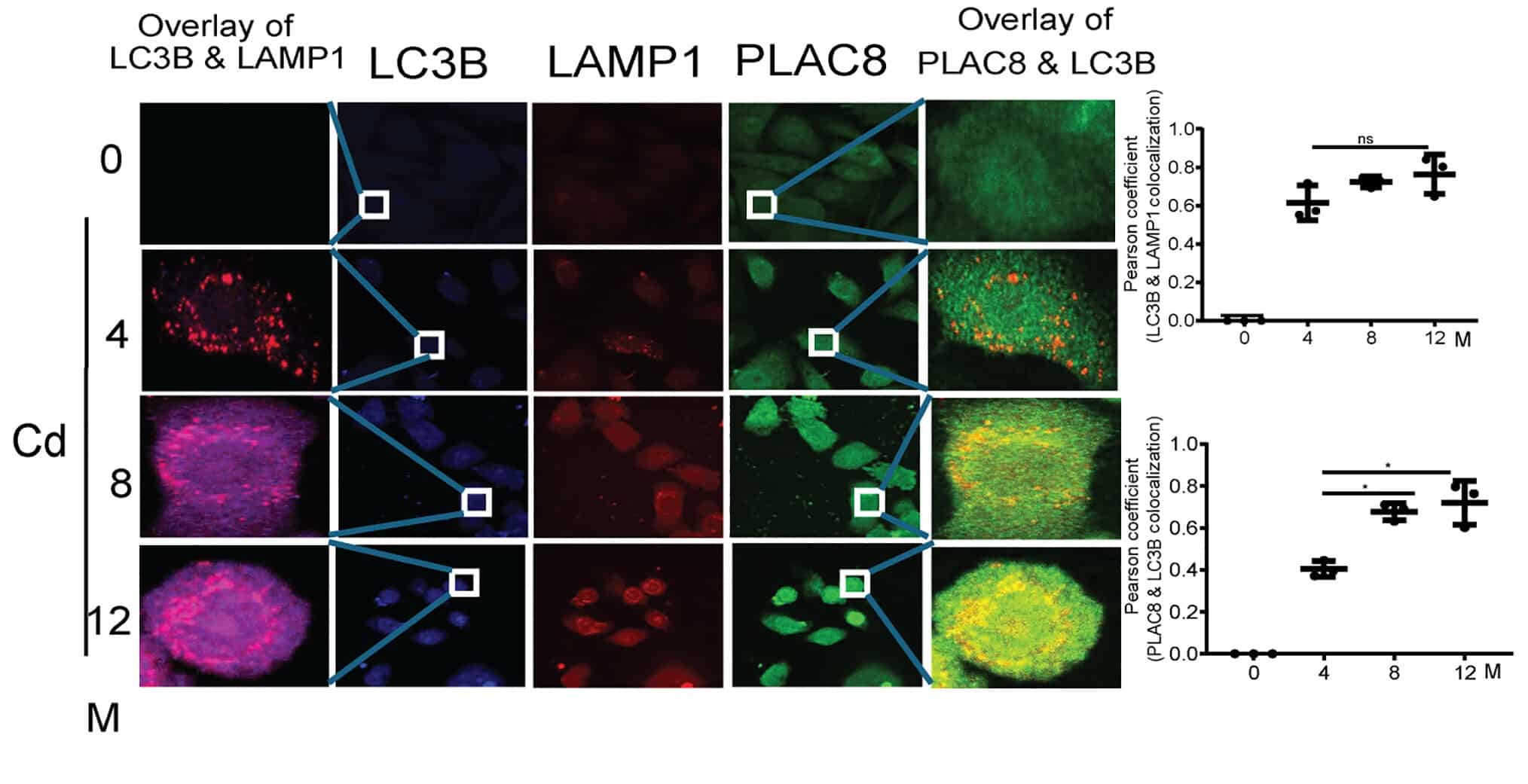Representative multicolor immunofluorescence images showing LC3B, LAMP1, and PLAC8 localization during cadmium-induced transformation (0–12 months). Pearson correlation coefficients quantify the shift from LC3B–LAMP1 to LC3B–PLAC8 colocalization across transformation stages.