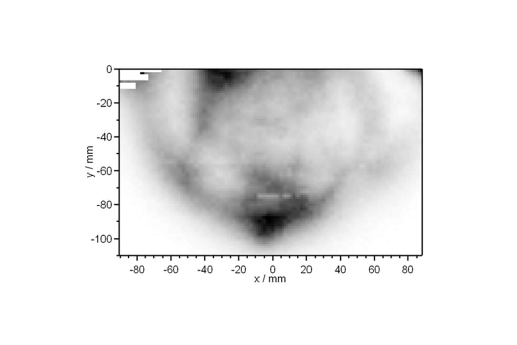 Mammography result obtained using diffuse optical imaging (DOI).