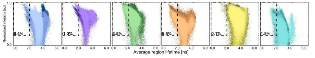 Scatter plots showing the relationship between average fluorescence lifetime and normalized fluorescence intensity across human liver tissue regions measured by FAD autofluorescence FLIM. The dashed boxes define the FLIM-associated metabolic dysfunction (FAMD) index, which includes regions with short fluorescence lifetimes (< 2 ns) and elevated fluorescence intensity (> 10%). Samples with higher FAMD indices contain larger populations of metabolically altered tissue regions, consistent with disrupted mitochondrial metabolism and increased metabolic heterogeneity.