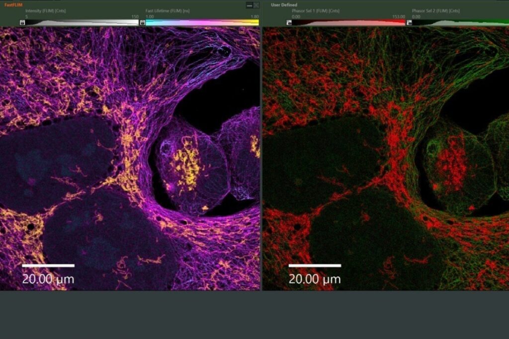 FLIM lifetime imaging microscopy of cells analyzed with NovaFLIM showing fast lifetime map and phasor-based species separation.