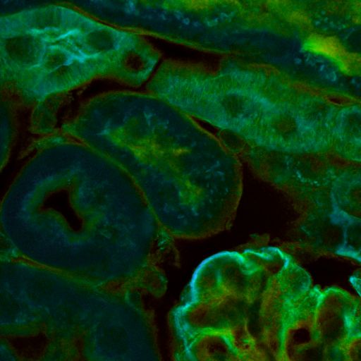 FLIM image of a cell culture showing lifetime variations between individual cells, where shorter lifetimes indicate higher metabolic activity.