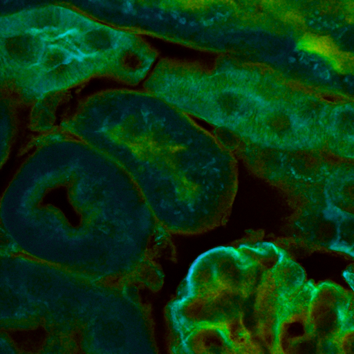 Fluorescence lifetime imaging microscopy of cell culture highlighting metabolic differences based on color-coded lifetime values.