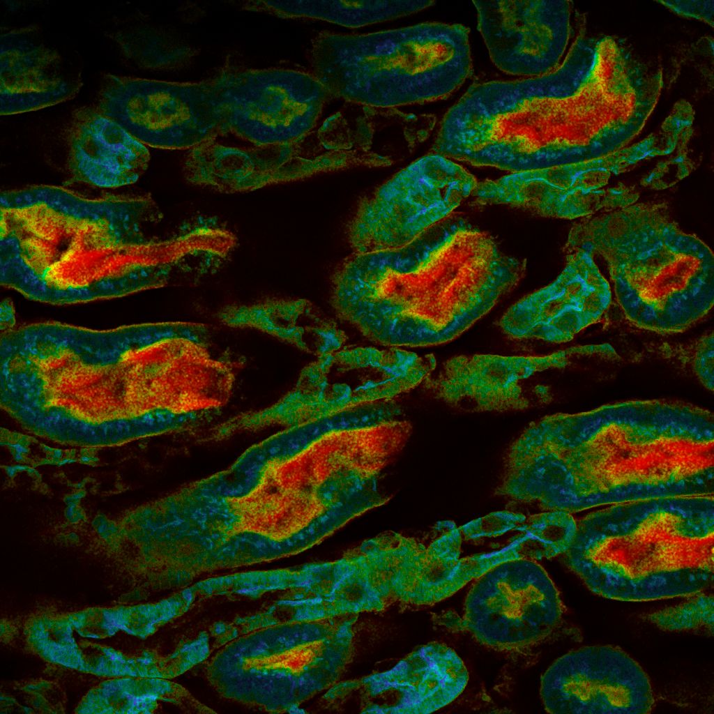 FLIM image of cultured cells revealing heterogeneous fluorescence lifetime patterns across cytoplasm and nuclei, reflecting metabolic and microenvironmental differences.