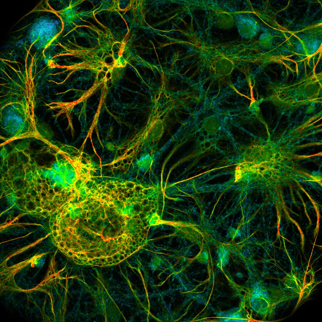 FLIM image of fixed primary neuronal cells stained for synapses (PSD95), intermediate filaments (GFAP), and mitochondria (TOM20). Sample courtesy of the Rizzoli Group, Department of Neuro- and Sensory Physiology, University of Göttingen Medical Center.