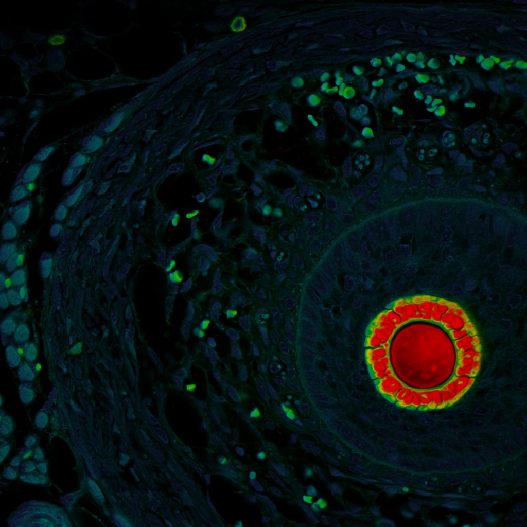 FLIM image of mouse tissue highlighting lifetime contrasts between structural and functional regions, reflecting differences in oxygenation and biochemical composition.