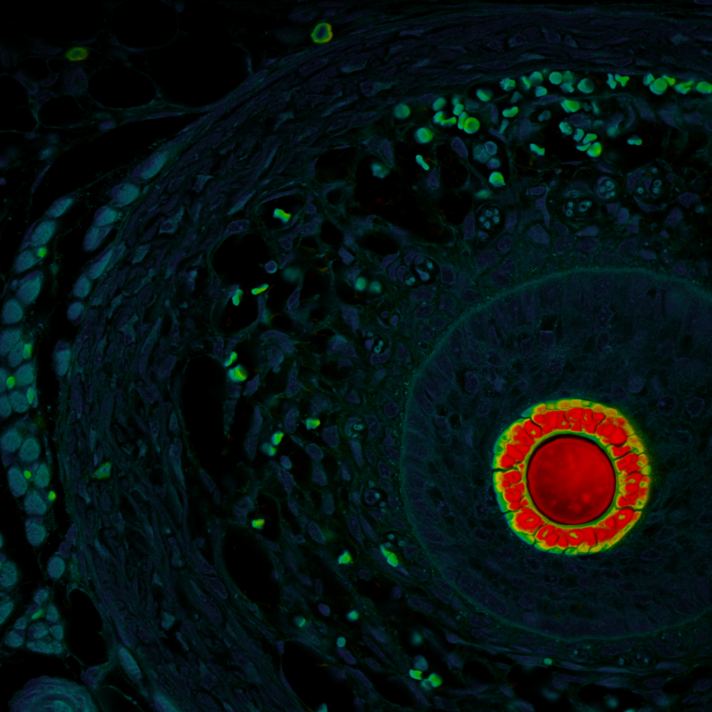 Fluorescence lifetime imaging microscopy of mouse tissue demonstrating functional contrast through spatial lifetime variation.